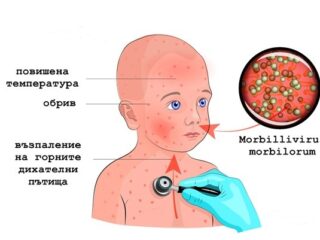 морбили1-320x240.jpg